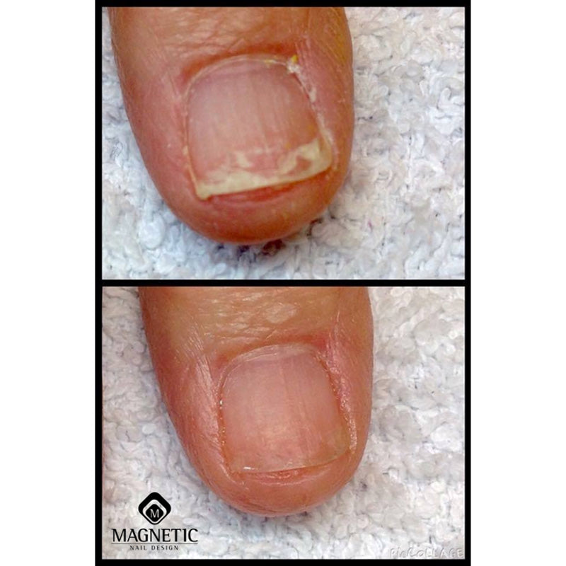 Seal & Protect Solution · Magnetic für Nageldesign Nägel & Nagelstudios Seal & Protect Solution · Magnetic, Nagelaufbau, Nagelpflege für Nägel im Nageldesign & Nagelstudios